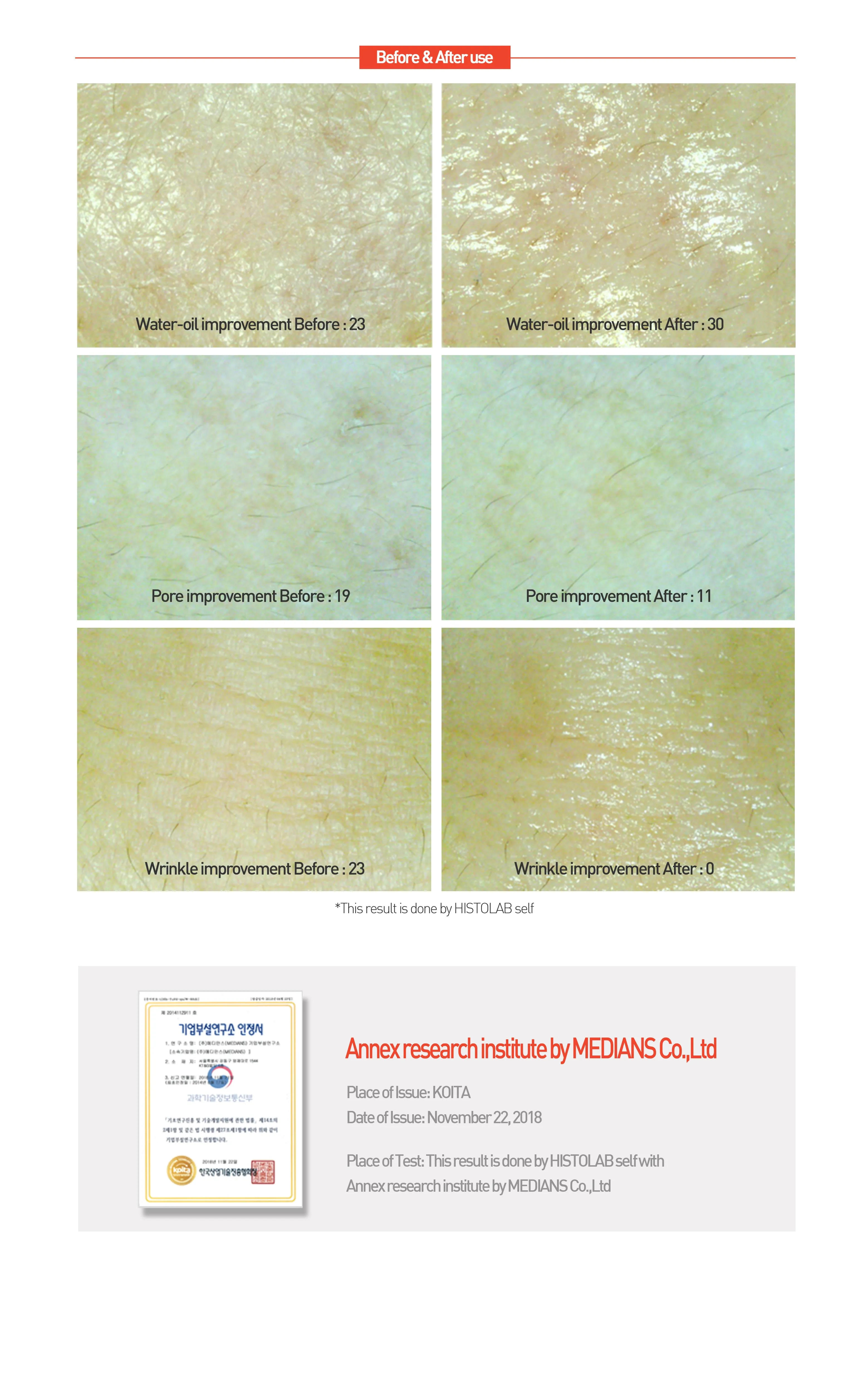 CENTELLA RED CREAM (previously HYDROGEL REGENERATING CENTELLA CREAM)